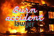 Burn accident lawyer.